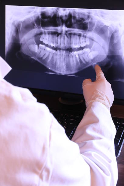 Best Knocked-Out Tooth Emergency  in Glenvar Heights, FL